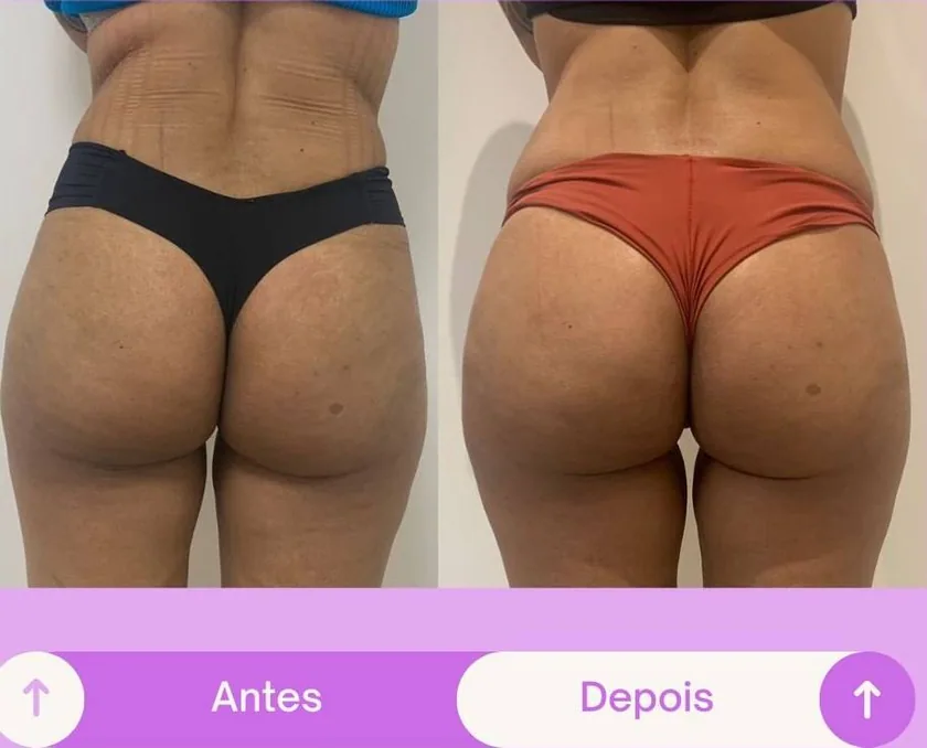 Antes e depois 3