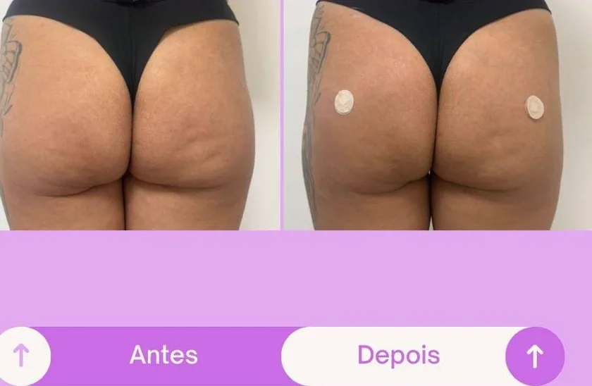 Antes e depois 6